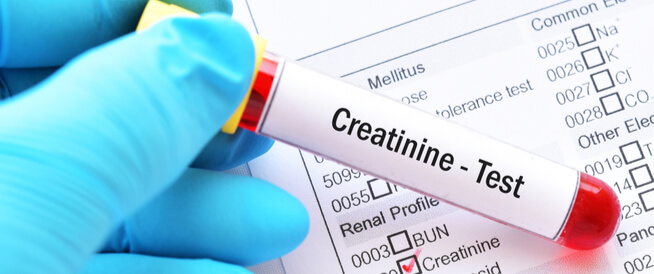 تحليل creatinine