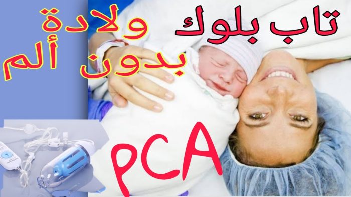 PCA والتاب بلوك للعملية القيصرية