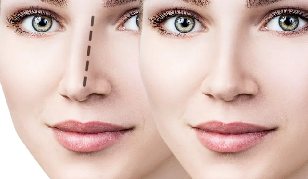 نسبة عمليات التجميل في السعودية