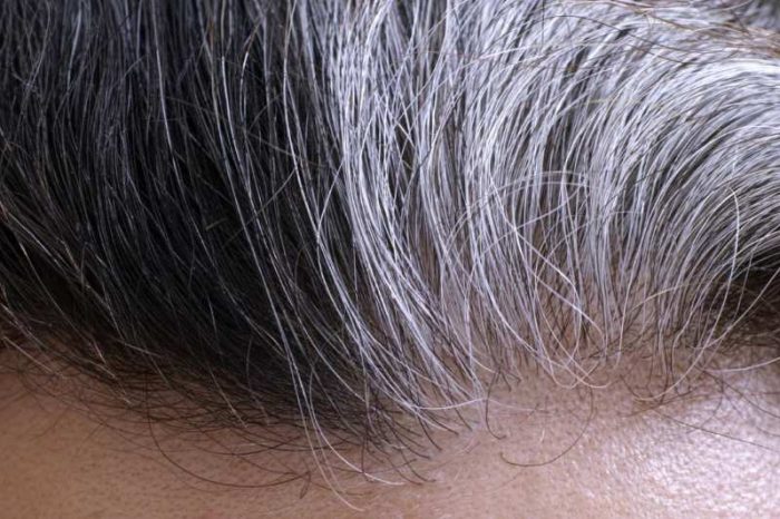 كيفية التخلص من الشعر الأبيض بدون صبغة
